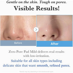 Medicube Zero Pore Pad - 70 Pads